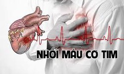 Nhồi m&#225;u cơ tim bệnh l&#253; nguy hiểm đe doạ t&#237;nh mạng bằng c&#225;i chết rất nhanh