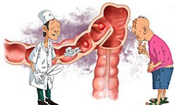 Đối ph&#243; với  vi&#234;m đại tr&#224;ng