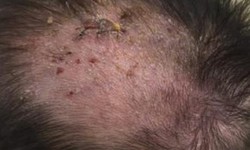 D&#249;ng thuốc chữa chốc l&#226;y ở trẻ