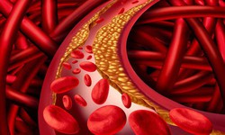 Những “thủ phạm” g&#226;y m&#225;u nhiễm mỡ