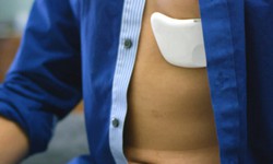 Miếng d&#225;n đo nhịp tim Life Rx