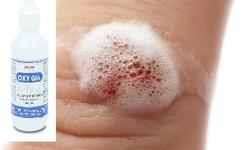 Điều cần biết khi sử dụng dung dịch sát khuẩn