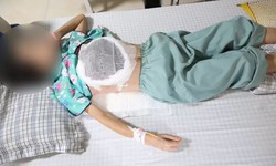 Mất một b&#234;n v&#250; v&#236; nghe lời “thầy lang” chữa ung thư