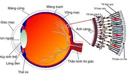 Tim mạch - Nội tiết - M&#225;u - Những bệnh l&#253; li&#234;n quan đến mắt kh&#244;ng thể chủ quan