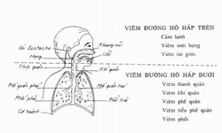 Tăng đề kh&#225;ng cho trẻ khi giao m&#249;a bằng nấm men