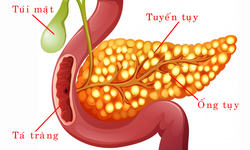 Hỗ trợ dự ph&#242;ng tiểu đường với phương ph&#225;p từ Nhật Bản