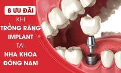 8 ưu đ&#227;i khi trồng răng Implant tại Nha khoa Đ&#244;ng Nam