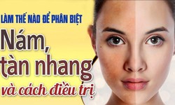 Cách phân biệt nám, tàn nhang, đồi mồi và cách điều trị hiệu quả