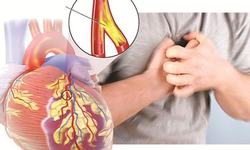 Phức hợp 4 thảo dược trong hỗ trợ kiểm soát mỡ máu