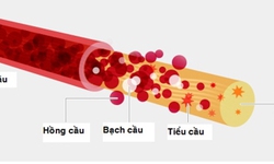 Thuốc mới trị giảm tiểu cầu ở bệnh gan m&#227;n t&#237;nh