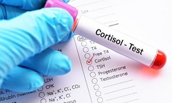 Cortisol cao l&#224;m tăng nguy cơ tử vong do COVID-19