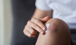 Vết bầm t&#237;m, chảy m&#225;u do d&#249;ng thuốc c&#243; nguy hiểm?
