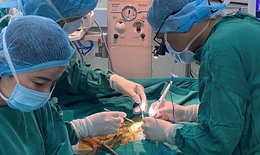 Hy hữu: Phẫu thuật cứu trẻ 26 ng&#224;y tuổi, nặng 1kg mắc tim bẩm sinh c&#242;n ống động mạch