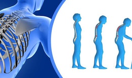 Đông y hỗ trợ phòng, trị loãng xương