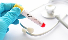 Virus RSV - 'Kẻ thù' gây bệnh hô hấp ở trẻ nhỏ