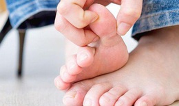 Thường xuyên ăn các món từ nước hầm xương, bé gái 7 tuổi mắc 'bệnh của người già'