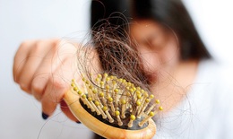 Rụng tóc: Nguyên nhân, chẩn đoán và thuốc chữa