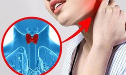 Ung thư tuyến giáp: Sự phát triển của khối u và khả năng di căn
