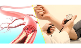 Báo động nguy cơ đột quỵ ở những người huyết áp cao