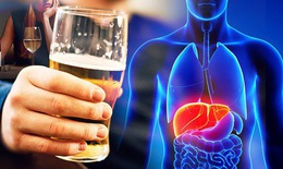 Tổn thương gan do rượu – Bệnh từ miệng vào