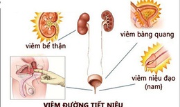 Viêm đường tiết niệu do vi khuẩn, triệu chứng và các thuốc điều trị