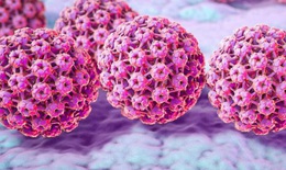 Vaccine HPV gi&#250;p giảm gần 90% nguy cơ ung thư cổ tử cung