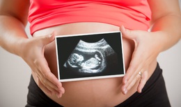 Nhau tiền đạo ở phụ nữ mang thai và hướng điều trị