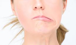 Các phương pháp điều trị liệt mặt ngoại biên