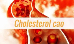 Cholesterol cao: Thủ phạm nguy hiểm gây ra những bệnh lý về tim mạch 