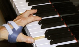 Các cách giúp bệnh viêm khớp dạng thấp không trầm trọng thêm