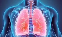 Chăm sóc phổi đúng cách trong mùa dịch COVID-19