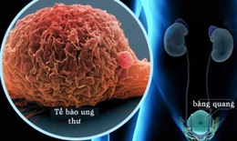 Chuyên gia chỉ rõ việc bệnh nhân ung thư tiết niệu cần làm trong dịch COVID-19