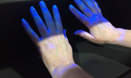 Không nên sử dụng đèn diệt khuẩn cực tím (UV) để khử trùng tay hoặc các vùng da khác