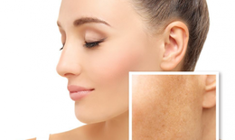 Tranexamic Acid có gây kích ứng da?