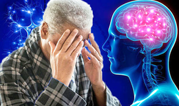 Nhiễm COVID- 19 có thể gây bệnh Alzheimer?