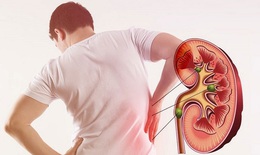 Chế độ ăn giúp bảo tồn chức năng thận cho người suy thận mạn
