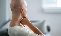 Những tác dụng phụ của xạ trị có thể gặp khi điều trị ung thư