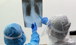 Bình Dương sẽ thực hiện biện pháp mạnh để khống chế dịch