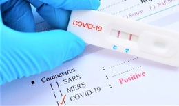 Chỉ mua sản phẩm kit test COVID-19 nằm trong danh mục Bộ Y tế cấp phép lưu hành