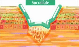 Thu hồi lô thuốc dạ dày Sucrate gel kém chất lượng