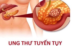 Hiệu quả từ phối hợp thuốc mới trong điều trị ung thư tuyến tụy