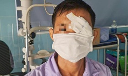 Mua cò về làm thịt một người đàn ông bị cò mổ thủng mắt