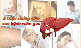 5 triệu chứng sớm của viêm gan và gợi ý hỗ trợ gan phục hồi