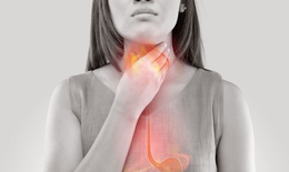 3 điều cầu lưu ý trong bệnh trào ngược họng thanh quản