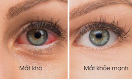 Ăn gì để cải thiện chứng khô mắt?