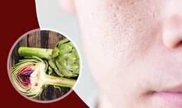 Atiso, 'thần dược' chống lão hóa và ngăn ngừa mụn