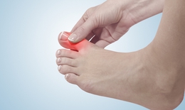 9 bài tập giảm đau do viêm khớp ngón chân cái