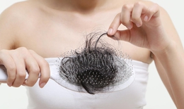 Khắc phục nỗi ám ảnh rụng tóc ở phụ nữ
