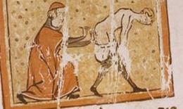 Thời cổ xưa con người từng dùng đỉa, than nóng để chữa bệnh trĩ