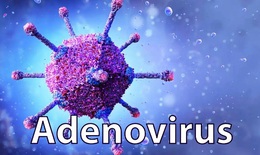 Kh&#244;ng x&#233;t nghiệm tr&#224;n lan Adenovirus ở trẻ em